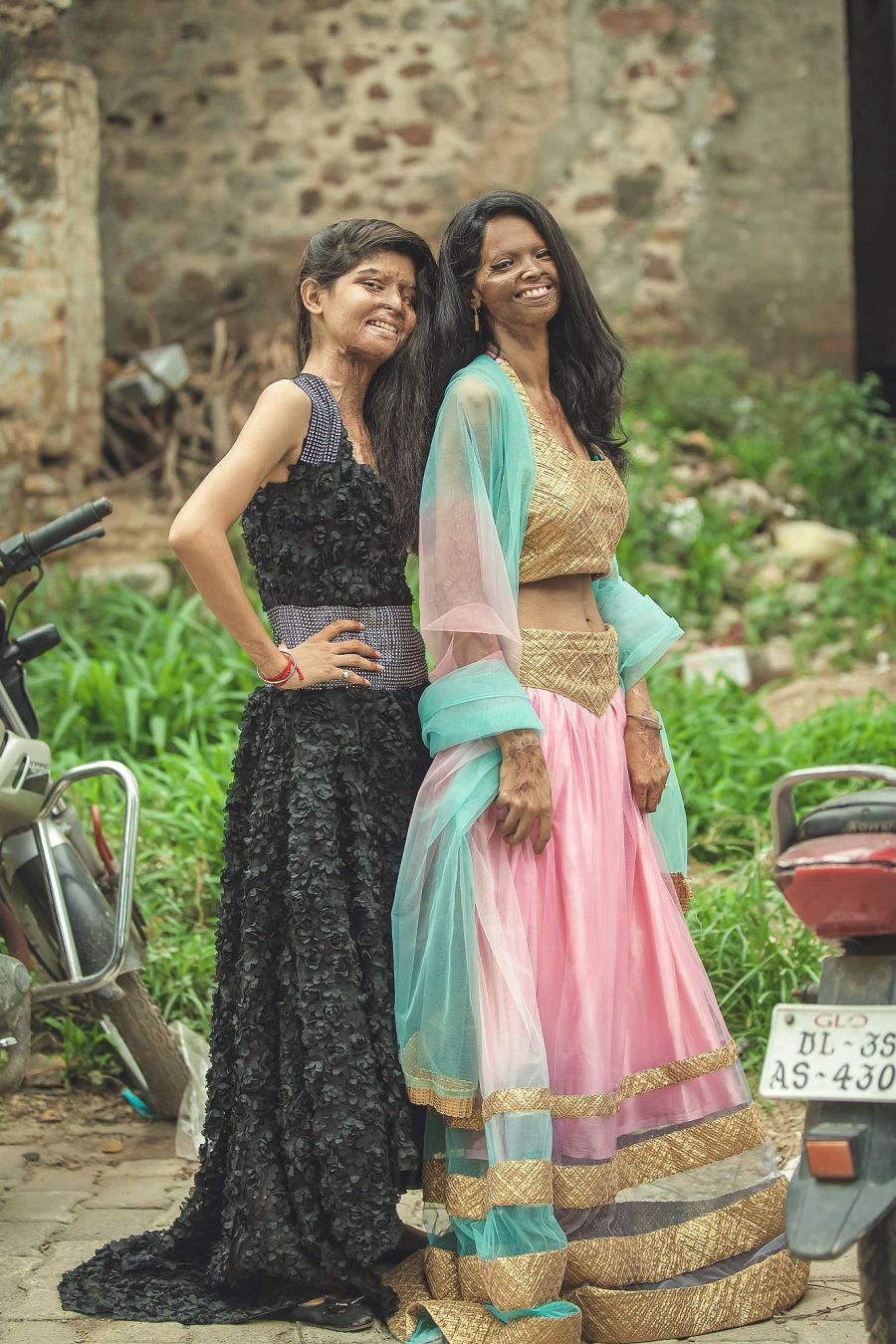 фотосессия индийских женщин, изуродованных кислотой