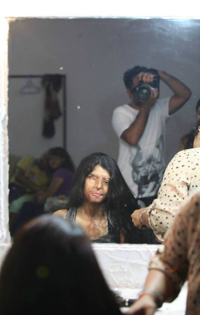 фотосессия индийских женщин, изуродованных кислотой