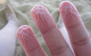 Почему кожа на ваших пальцах сморщивается, когда вы принимаете ванну?